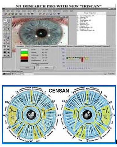 Iridologia Digital analisis del iris por computadora en Zona Oeste Capital Federal Centro de Atencion Tratamientos Diagnostico